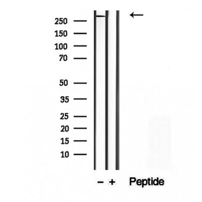 DF12322 at 1/100 staining Mouse liver tissue by IHC-P. The sample was formaldehyde fixed and a heat mediated antigen retrieval step in citrate buffer was performed. The sample was then blocked and incubated with the antibody for 1.5 hours at 22¡ãC. An HRP conjugated goat anti-rabbit antibody was used as the secondary