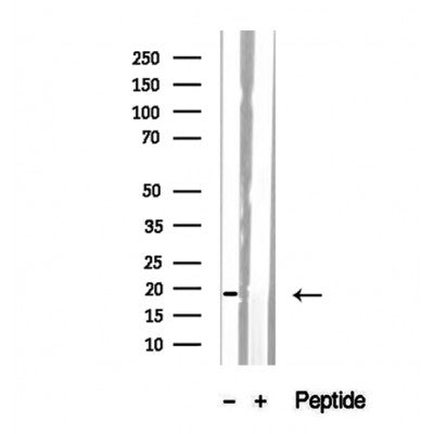 Western blot analysis of extracts from Hela, using SRP14 antibody. Lane 1 was treated with the blocking peptide.