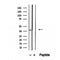 DF12326 staining Hela by IF/ICC. The sample were fixed with PFA and permeabilized in 0.1% Triton X-100,then blocked in 10% serum for 45 minutes at 25¡ãC. The primary antibody was diluted at 1/200 and incubated with the sample for 1 hour at 37¡ãC. An  Alexa Fluor 594 conjugated goat anti-rabbit IgG (H+L) Ab, diluted at 1/600, was used as the secondary antibod