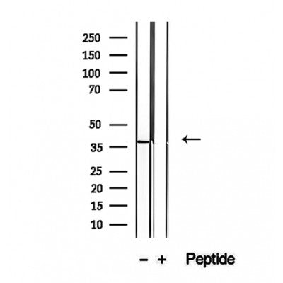 DF12326 staining Hela by IF/ICC. The sample were fixed with PFA and permeabilized in 0.1% Triton X-100,then blocked in 10% serum for 45 minutes at 25¡ãC. The primary antibody was diluted at 1/200 and incubated with the sample for 1 hour at 37¡ãC. An  Alexa Fluor 594 conjugated goat anti-rabbit IgG (H+L) Ab, diluted at 1/600, was used as the secondary antibod