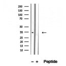 Western blot analysis of extracts from various samples, using SULT1C2 antibody.
 Lane 1: rat brain treated with blocking peptide.
 Lane 2: Rat brain;
 Lane 3: B16F10;
 