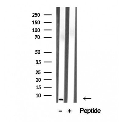 Western blot analysis of extracts from 293, using TMSB4X Antibody. Lane 1 was treated with the blocking peptide.