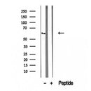 Western blot analysis of extracts from 3T3, using TRIM9 antibody. Lane 1 was treated with the blocking peptide.