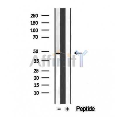 Western blot analysis of extracts from various samples, using UQCRC1 antibody.
 Lane 1: rat brain treated with blocking peptide.
 Lane 2: Rat brain;
 Lane 3: 293;
 Lane 4: Mouse myeloma;
 Lane 5: B16F10;
 