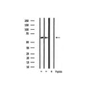 Western blot analysis of extracts from various samples, using Src Antibody.
 Lane 1: Mouse brain treated with blocking peptide;
 Lane 2: Mouse brain;
Lane 3: Hybridoma cells;
Lane 4: HeLa;
Lane 5: Vero.