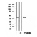 DF12340 at 1/100 staining Human lymph cancer tissue by IHC-P. The sample was formaldehyde fixed and a heat mediated antigen retrieval step in citrate buffer was performed. The sample was then blocked and incubated with the antibody for 1.5 hours at 22¡ãC. An HRP conjugated goat anti-rabbit antibody was used as the secondary