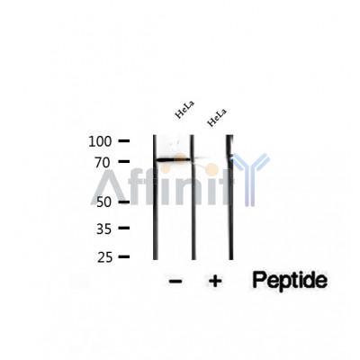 DF12342 at 1/100 staining Human kidney tissue by IHC-P. The sample was formaldehyde fixed and a heat mediated antigen retrieval step in citrate buffer was performed. The sample was then blocked and incubated with the antibody for 1.5 hours at 22¡ãC. An HRP conjugated goat anti-rabbit antibody was used as the secondary