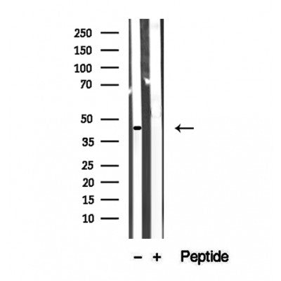 Western blot analysis of extracts from Hela, using ACAA1 Antibody. The lane on the left was treated with blocking peptide.