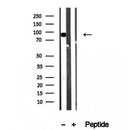 Western blot analysis of extracts from B16F10, using Aconitase 2 Antibody. The lane on the left was treated with blocking peptide.