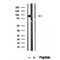 Western blot analysis of extracts from B16F10, using Aconitase 2 Antibody. The lane on the left was treated with blocking peptide.