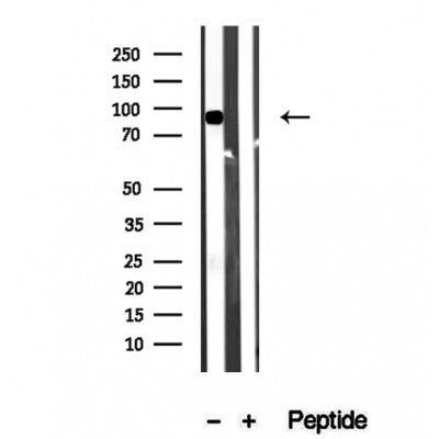 Western blot analysis of extracts from B16F10, using Aconitase 2 Antibody. The lane on the left was treated with blocking peptide.
