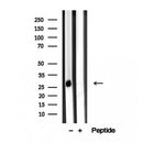 Western blot analysis of extracts from Mouse lung, using ARHGDIB Antibody. The lane on the left was treated with blocking peptide.