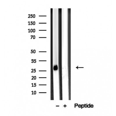 Western blot analysis of extracts from Mouse lung, using ARHGDIB Antibody. The lane on the left was treated with blocking peptide.