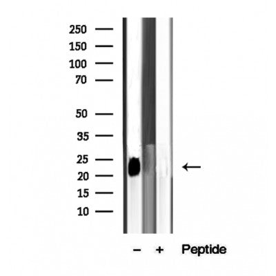 Western blot analysis of extracts from 3T3, using ARL8B antibody. Lane 1 was treated with the blocking peptide.