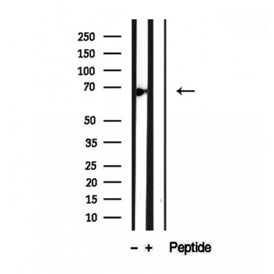 Western blot analysis of extracts from various samples, using ATP6V1A antibody.
 Lane 1: rat brain treated with blocking peptide.
 Lane 2: Rat brain;
 Lane 3: B16F10;
 