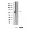 Western blot analysis of extracts from Hela, using BAMBI antibody. Lane 1 was treated with the blocking peptide.