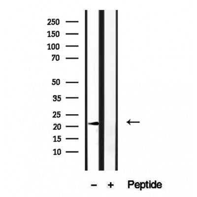 Western blot analysis of extracts from Hela, using BBS3 Antibody. The lane on the left was treated with blocking peptide.