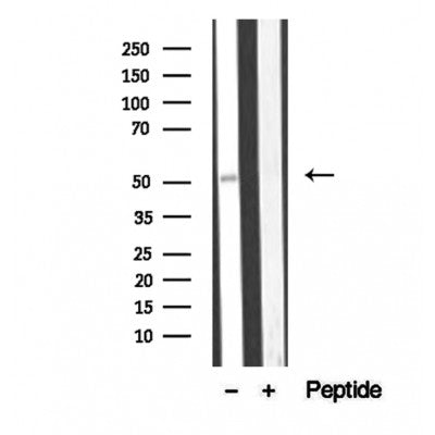 Western blot analysis of extracts from mouse brain, using BBS4 antibody. Lane 1 was treated with the blocking peptide.