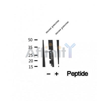 DF12359 at 1/100 staining Mouse lung tissue by IHC-P. The sample was formaldehyde fixed and a heat mediated antigen retrieval step in citrate buffer was performed. The sample was then blocked and incubated with the antibody for 1.5 hours at 22¡ãC. An HRP conjugated goat anti-rabbit antibody was used as the secondary