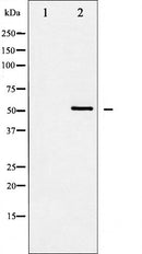 AF6163 at 1/100 staining Human breast cancer tissue by IHC-P. The sample was formaldehyde fixed and a heat mediated antigen retrieval step in citrate buffer was performed. The sample was then blocked and incubated with the antibody for 1.5 hours at 22¡ãC. An HRP conjugated goat anti-rabbit antibody was used as the secondary