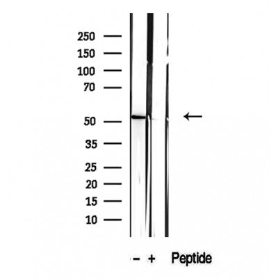 Western blot analysis of extracts from 293, using CALCOCO2 antibody. Lane 1 was treated with the blocking peptide.