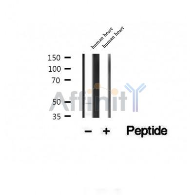 DF12363 at 1/100 staining Human melanoma tissue by IHC-P. The sample was formaldehyde fixed and a heat mediated antigen retrieval step in citrate buffer was performed. The sample was then blocked and incubated with the antibody for 1.5 hours at 22¡ãC. An HRP conjugated goat anti-rabbit antibody was used as the secondary