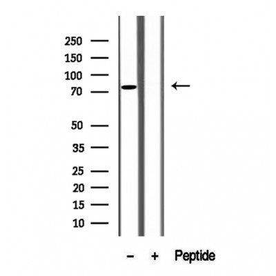 Western blot analysis of extracts from Mouse lung, using CIN85 Antibody. The lane on the left was treated with blocking peptide.
