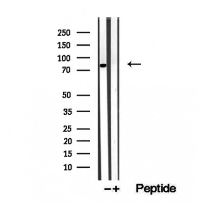 DF12366 staining Hela by IF/ICC. The samples were fixed with PFA and permeabilized in 0.1% Triton X-100,then blocked in 10% serum for 45 minutes at 25¡ãC. Samples were then incubated with primary Ab(DF12366 1:200) and mouse anti-beta tubulin Ab(T0023 1:200) for 1 hour at 37¡ãC. An  AlexaFluor594 conjugated goat anti-rabbit IgG(H+L) Ab(S0006 1:200 Red) and an AlexaFluor488 conjugated goat anti-mouse IgG(H+L) Ab(S0017 1:600 Green) were used as the secondary antibod