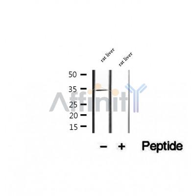 DF12368 at 1/100 staining Human kidney tissue by IHC-P. The sample was formaldehyde fixed and a heat mediated antigen retrieval step in citrate buffer was performed. The sample was then blocked and incubated with the antibody for 1.5 hours at 22¡ãC. An HRP conjugated goat anti-rabbit antibody was used as the secondary