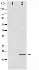 AF6232 staining COLO205 by IF/ICC. The sample were fixed with PFA and permeabilized in 0.1% Triton X-100,then blocked in 10% serum for 45 minutes at 25¡ãC. The primary antibody was diluted at 1/200 and incubated with the sample for 1 hour at 37¡ãC. An  Alexa Fluor 594 conjugated goat anti-rabbit IgG (H+L) Ab, diluted at 1/600, was used as the secondary antibod