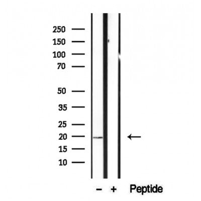 DF12370 at 1/100 staining Mouse brain tissue by IHC-P. The sample was formaldehyde fixed and a heat mediated antigen retrieval step in citrate buffer was performed. The sample was then blocked and incubated with the antibody for 1.5 hours at 22¡ãC. An HRP conjugated goat anti-rabbit antibody was used as the secondary