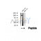 DF12375 at 1/100 staining Human pancreas cancer tissue by IHC-P. The sample was formaldehyde fixed and a heat mediated antigen retrieval step in citrate buffer was performed. The sample was then blocked and incubated with the antibody for 1.5 hours at 22¡ãC. An HRP conjugated goat anti-rabbit antibody was used as the secondary
