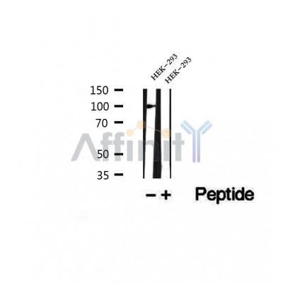DF12375 at 1/100 staining Human pancreas cancer tissue by IHC-P. The sample was formaldehyde fixed and a heat mediated antigen retrieval step in citrate buffer was performed. The sample was then blocked and incubated with the antibody for 1.5 hours at 22¡ãC. An HRP conjugated goat anti-rabbit antibody was used as the secondary