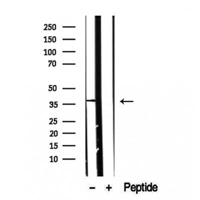 DF12378 staining Hela by IF/ICC. The samples were fixed with PFA and permeabilized in 0.1% Triton X-100,then blocked in 10% serum for 45 minutes at 25¡ãC. Samples were then incubated with primary Ab(DF12378 1:200) and mouse anti-beta tubulin Ab(T0023 1:200) for 1 hour at 37¡ãC. An  AlexaFluor594 conjugated goat anti-rabbit IgG(H+L) Ab(S0006 1:200 Red) and an AlexaFluor488 conjugated goat anti-mouse IgG(H+L) Ab(S0017 1:600 Green) were used as the secondary antibod