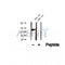DF12379 at 1/100 staining Human pancreas cancer tissue by IHC-P. The sample was formaldehyde fixed and a heat mediated antigen retrieval step in citrate buffer was performed. The sample was then blocked and incubated with the antibody for 1.5 hours at 22¡ãC. An HRP conjugated goat anti-rabbit antibody was used as the secondary
