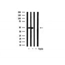 AF6233 at 1/100 staining Rat brain tissue by IHC-P. The sample was formaldehyde fixed and a heat mediated antigen retrieval step in citrate buffer was performed. The sample was then blocked and incubated with the antibody for 1.5 hours at 22¡ãC. An HRP conjugated goat anti-rabbit antibody was used as the secondary