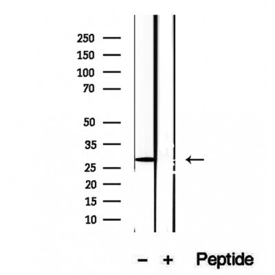 DF12382 staining Hela by IF/ICC. The samples were fixed with PFA and permeabilized in 0.1% Triton X-100,then blocked in 10% serum for 45 minutes at 25¡ãC. Samples were then incubated with primary Ab(DF12382 1:200) and mouse anti-beta tubulin Ab(T0023 1:200) for 1 hour at 37¡ãC. An  AlexaFluor594 conjugated goat anti-rabbit IgG(H+L) Ab(S0006 1:200 Red) and an AlexaFluor488 conjugated goat anti-mouse IgG(H+L) Ab(S0017 1:600 Green) were used as the secondary antibod