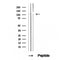 DF12383 at 1/100 staining Human breast cancer tissue by IHC-P. The sample was formaldehyde fixed and a heat mediated antigen retrieval step in citrate buffer was performed. The sample was then blocked and incubated with the antibody for 1.5 hours at 22¡ãC. An HRP conjugated goat anti-rabbit antibody was used as the secondary
