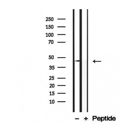 Western blot analysis of extracts from mouse brain, using DOM3Z antibody. Lane 1 was treated with the blocking peptide.