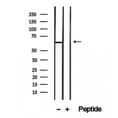 Western blot analysis of extracts from mouse intestine, using CD26 antibody. Lane 1 was treated with the blocking peptide.