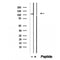 DF12388 staining Hela by IF/ICC. The sample were fixed with PFA and permeabilized in 0.1% Triton X-100,then blocked in 10% serum for 45 minutes at 25¡ãC. The primary antibody was diluted at 1/200 and incubated with the sample for 1 hour at 37¡ãC. An  Alexa Fluor 594 conjugated goat anti-rabbit IgG (H+L) Ab, diluted at 1/600, was used as the secondary antibod