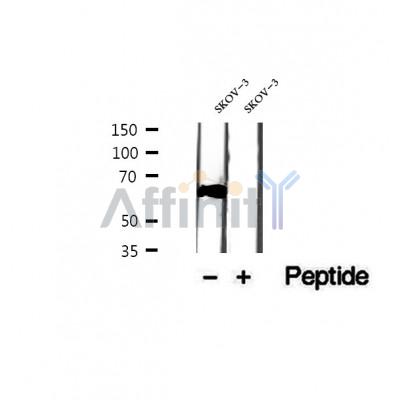 DF12390 at 1/100 staining Mouse kidney tissue by IHC-P. The sample was formaldehyde fixed and a heat mediated antigen retrieval step in citrate buffer was performed. The sample was then blocked and incubated with the antibody for 1.5 hours at 22¡ãC. An HRP conjugated goat anti-rabbit antibody was used as the secondary
