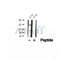 DF12392 at 1/100 staining Human pancreas cancer tissue by IHC-P. The sample was formaldehyde fixed and a heat mediated antigen retrieval step in citrate buffer was performed. The sample was then blocked and incubated with the antibody for 1.5 hours at 22¡ãC. An HRP conjugated goat anti-rabbit antibody was used as the secondary