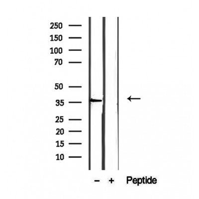 Western blot analysis of extracts from 293, using EIF3I Antibody. The lane on the left was treated with blocking peptide.
