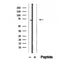 DF12395 staining Hela by IF/ICC. The sample were fixed with PFA and permeabilized in 0.1% Triton X-100,then blocked in 10% serum for 45 minutes at 25¡ãC. The primary antibody was diluted at 1/200 and incubated with the sample for 1 hour at 37¡ãC. An  Alexa Fluor 594 conjugated goat anti-rabbit IgG (H+L) Ab, diluted at 1/600, was used as the secondary antibod