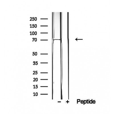 Western blot analysis of extracts from various samples, using EXOC5 Antibody.
Lane 1: 293 was treated with the blocking peptide;
Lane 2: 293 cells;
Lane 3: Hela cells.
Lane 4: Mouse liver tissue; 