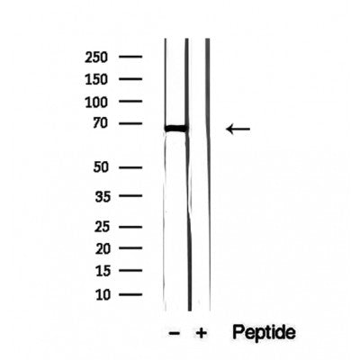 Western blot analysis of extracts from Mouse lung, using FAM65B Antibody. The lane on the left was treated with blocking peptide.