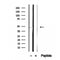 DF12399 staining Hela by IF/ICC. The sample were fixed with PFA and permeabilized in 0.1% Triton X-100,then blocked in 10% serum for 45 minutes at 25¡ãC. The primary antibody was diluted at 1/200 and incubated with the sample for 1 hour at 37¡ãC. An  Alexa Fluor 594 conjugated goat anti-rabbit IgG (H+L) Ab, diluted at 1/600, was used as the secondary antibod