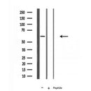 Western blot analysis of extracts from VERO, using FBXW7 Antibody. The lane on the left was treated with blocking peptide.