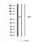 Western blot analysis of extracts from VERO, using FBXW7 Antibody. The lane on the left was treated with blocking peptide.